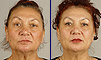 Dental facelift case of the month - December 2008