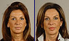 Dental facelift case of the month - January 2009