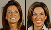 Dental facelift case of the month - January 2009